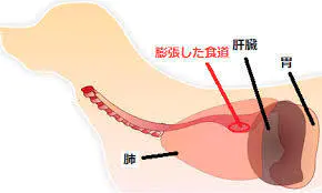 巨大食道症
